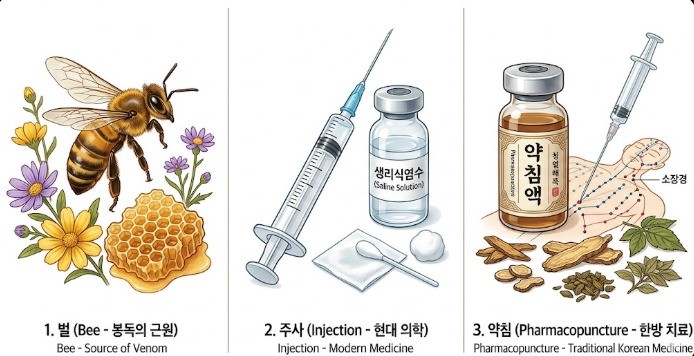 봉독요법이란? 20여 년의 경험으로 놓는 벌침 치료