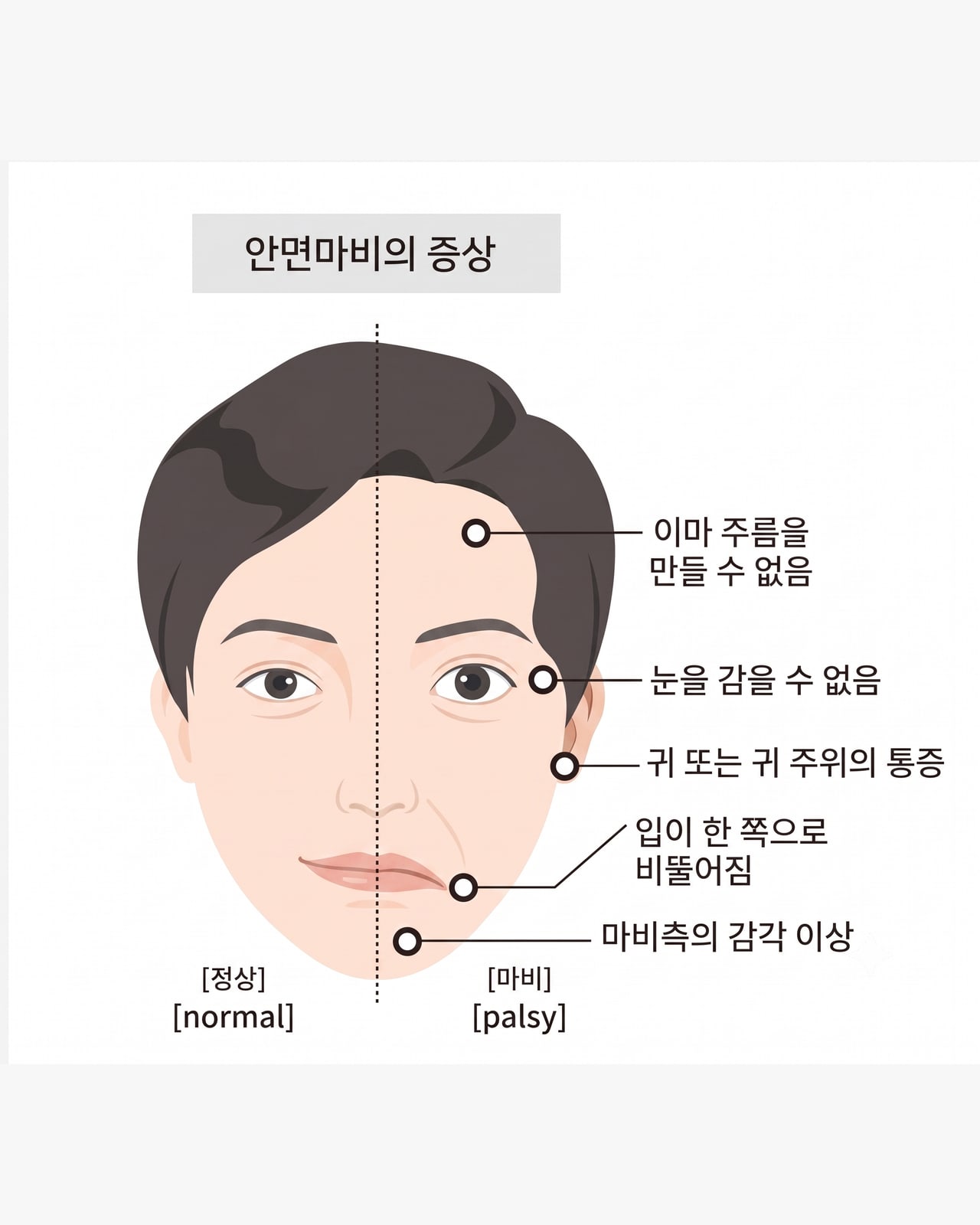 안면마비(구안와사) 클리닉