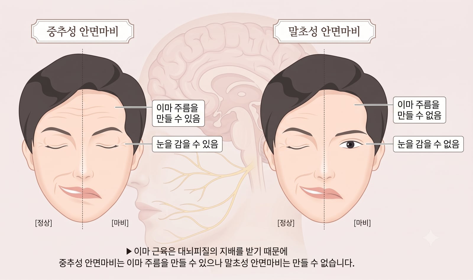 여름에도 안면마비가 옵니다 — 에어컨 바람과 구안와사